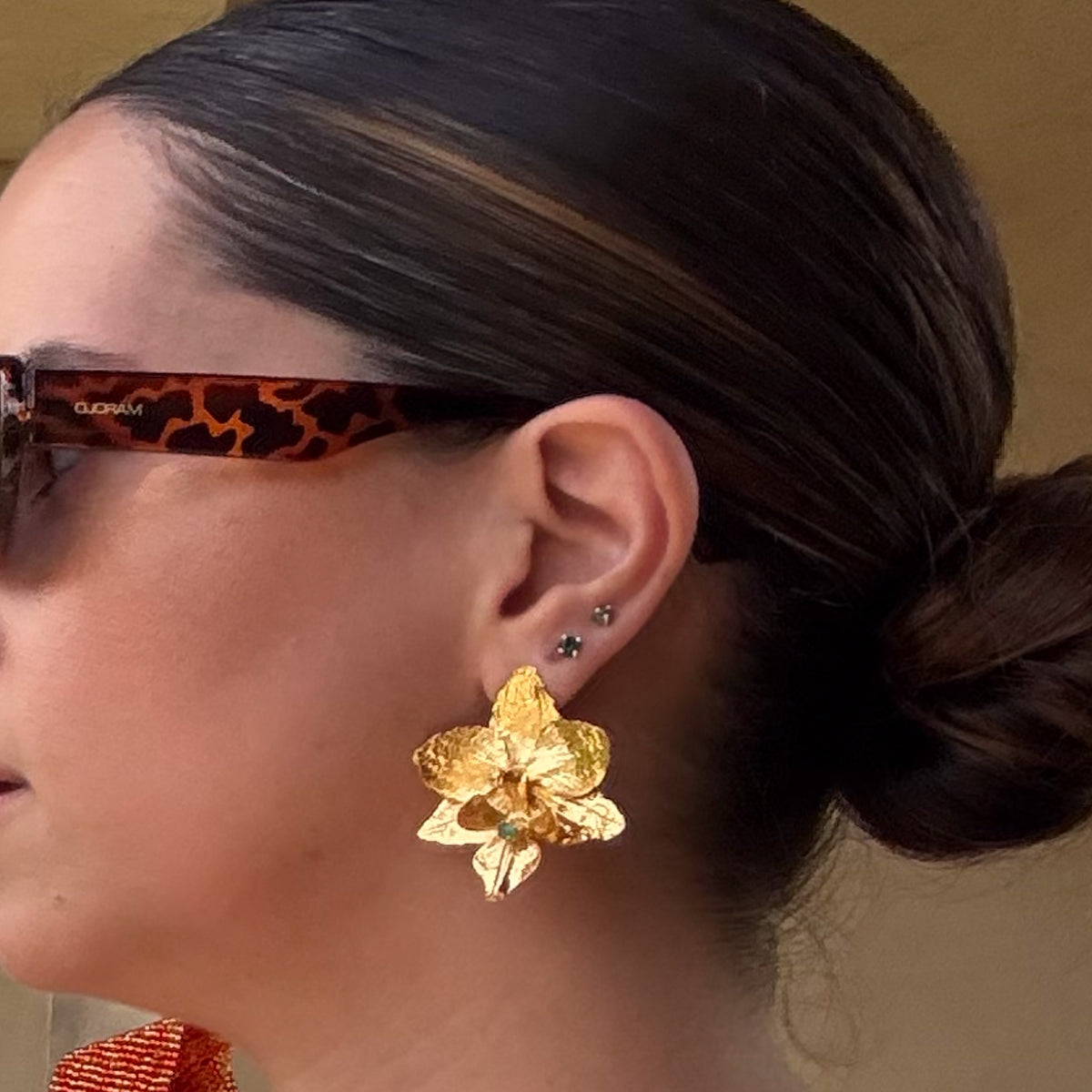 Aretes
